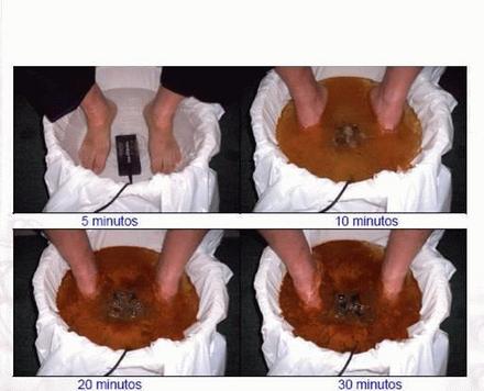 Detoxificación  Iónica